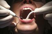 Британские стоматологи изобрели способ избавить пациентов от неприятных звуков бормашины