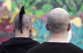 Мужские ноги – новый источник волос для трансплантации