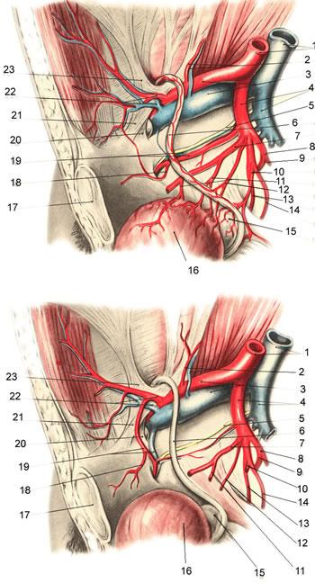 Варианты отхождения a. obturatoriae