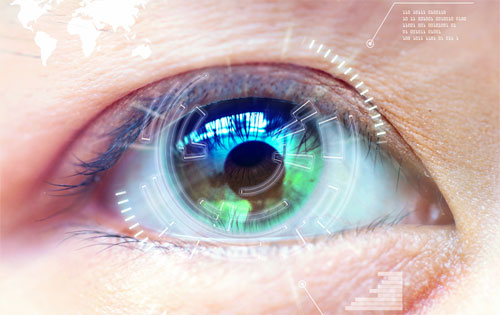 LASIK
